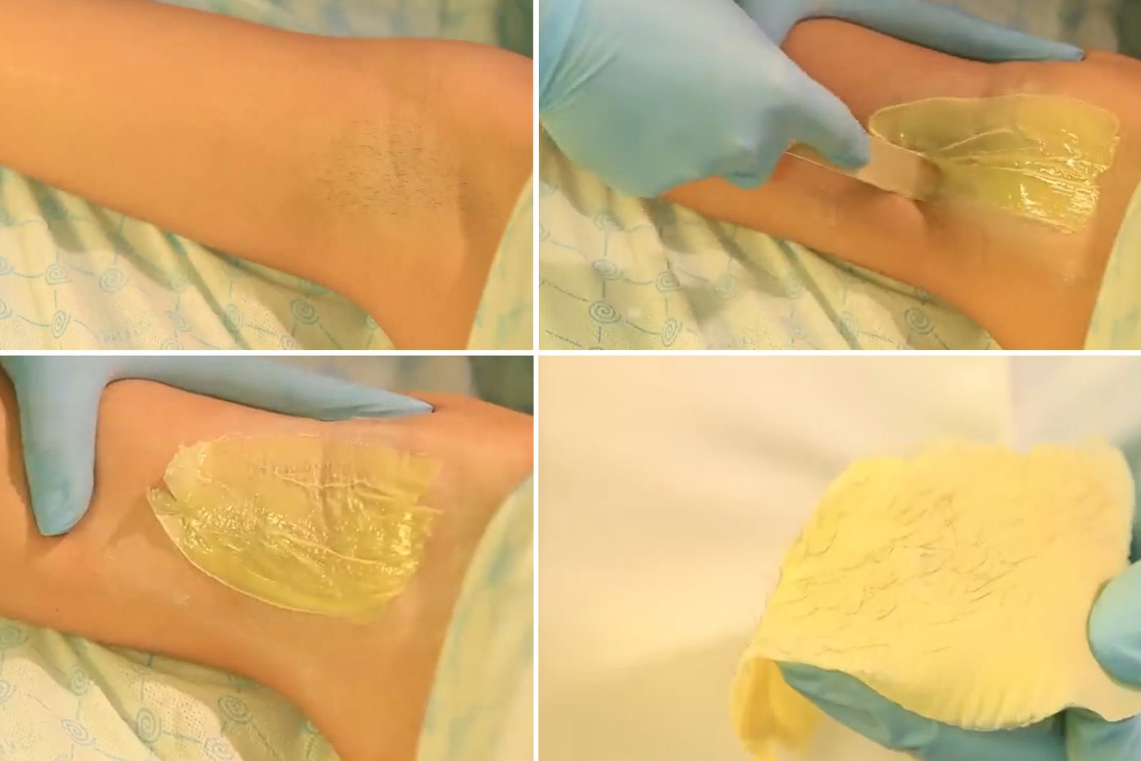 steps of underarm waxing