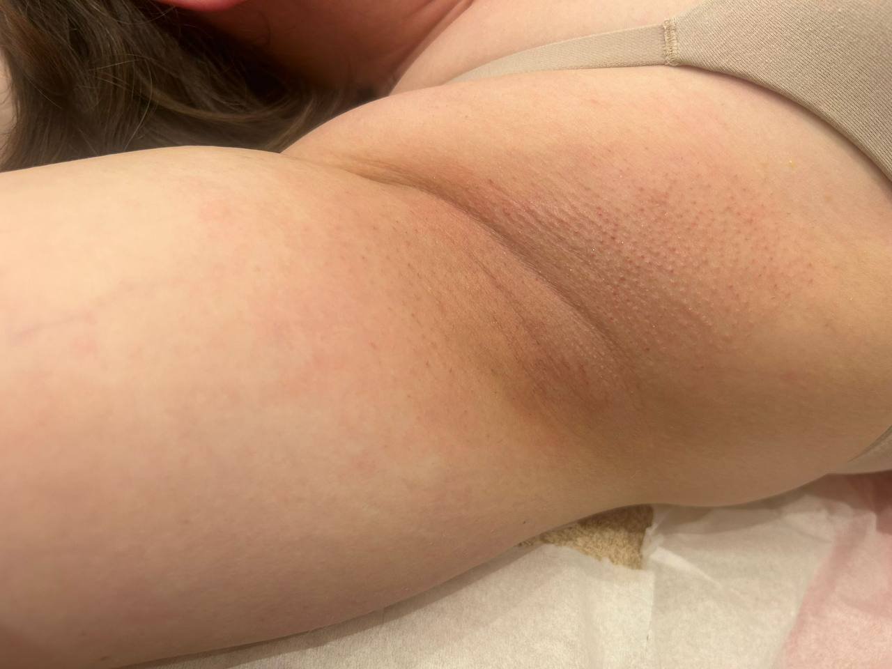 waxing underarm after at Body Silk Clinic London