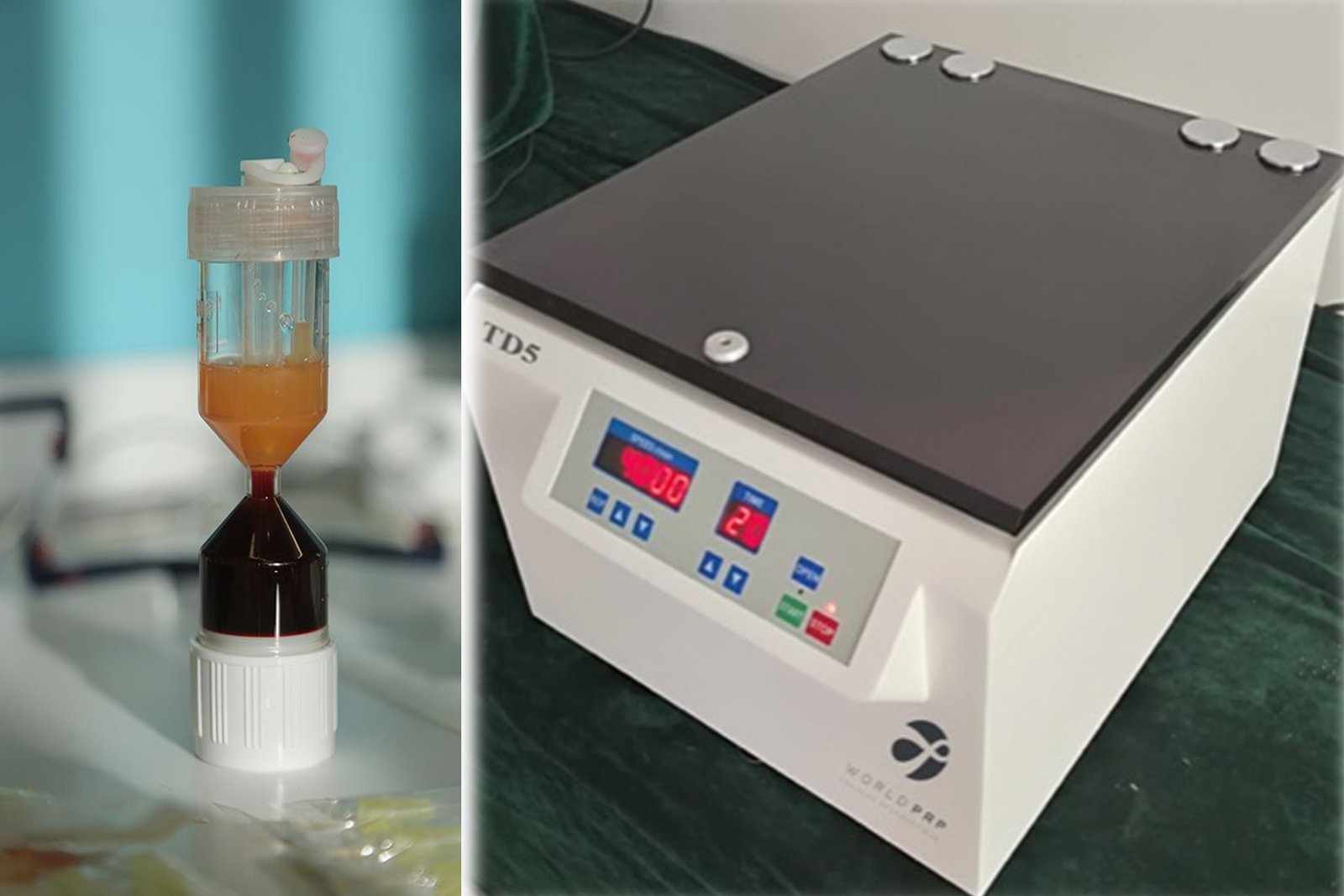 PRP therapy, the Centrifuge Machine