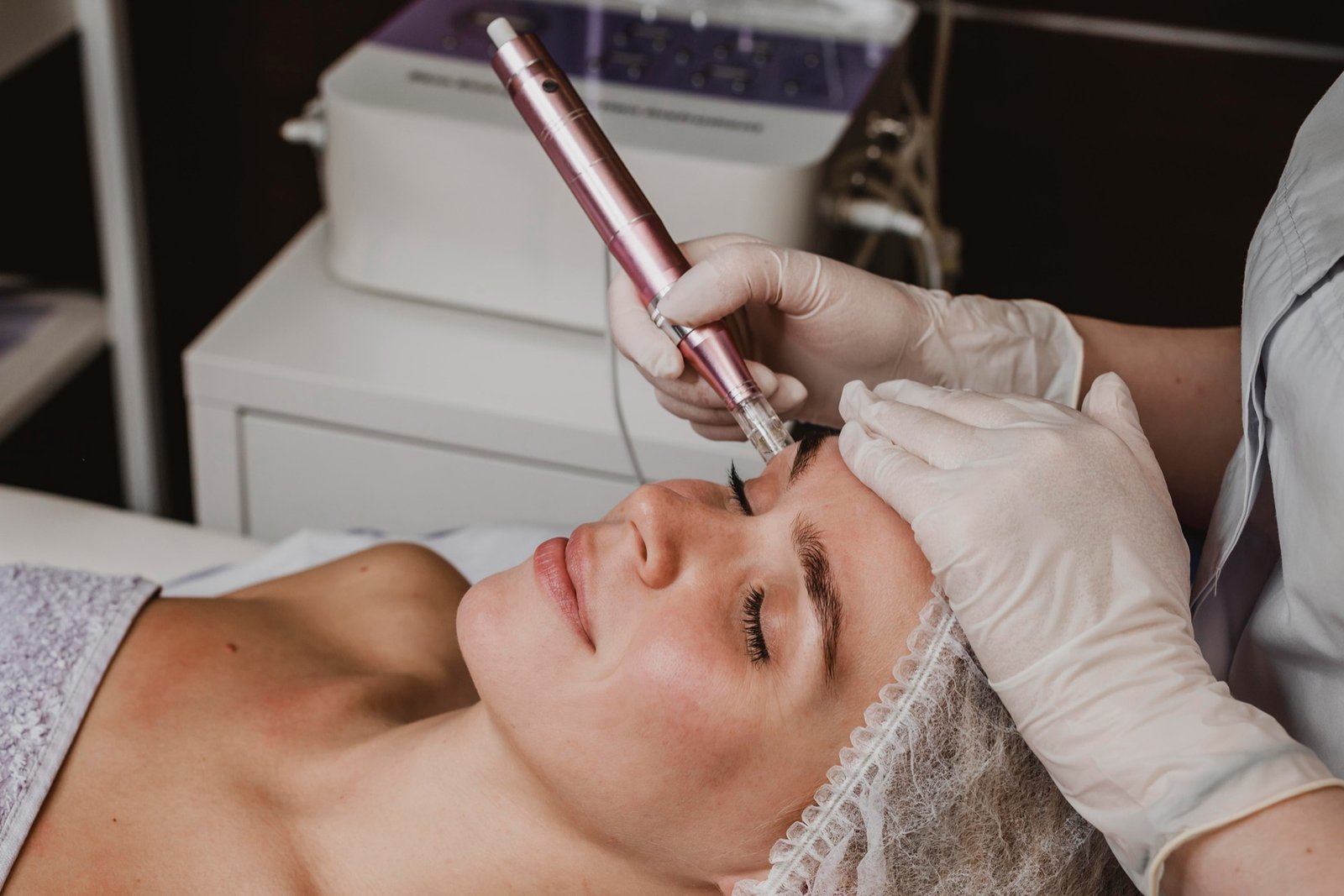 microneedling treatment at Clinic