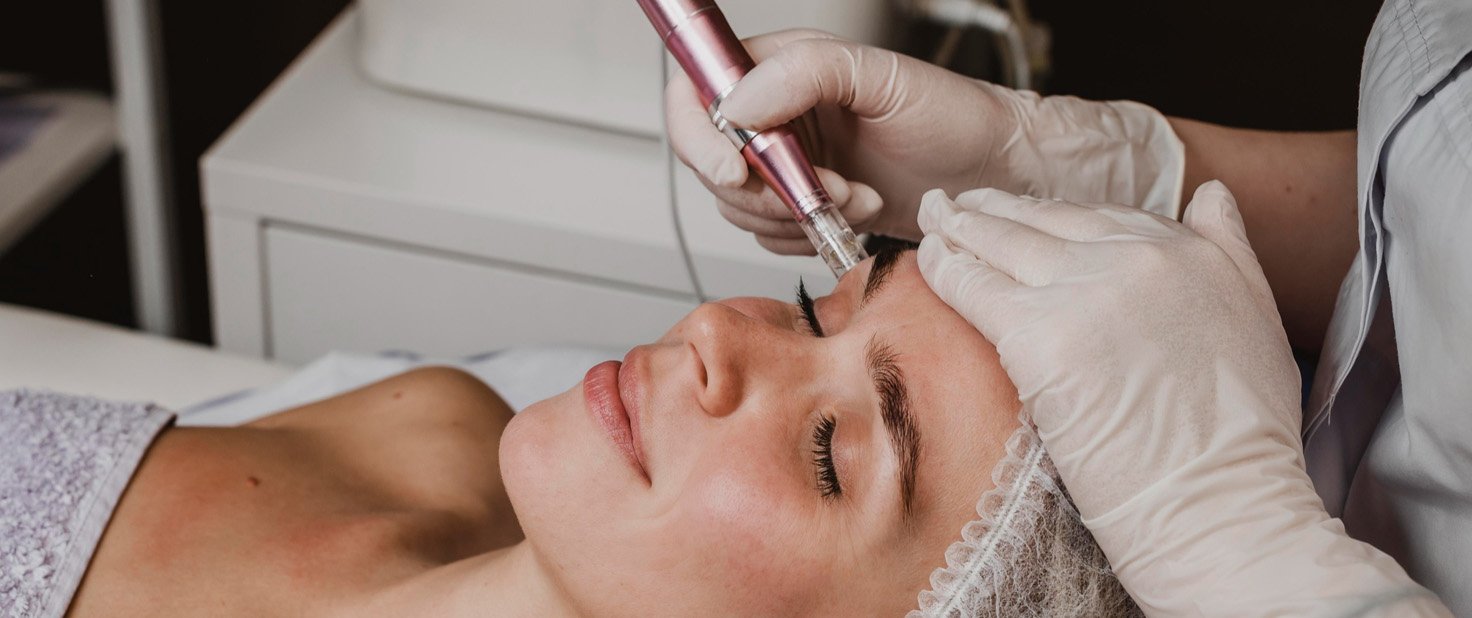 dermapen microneedling treatment at Clinic