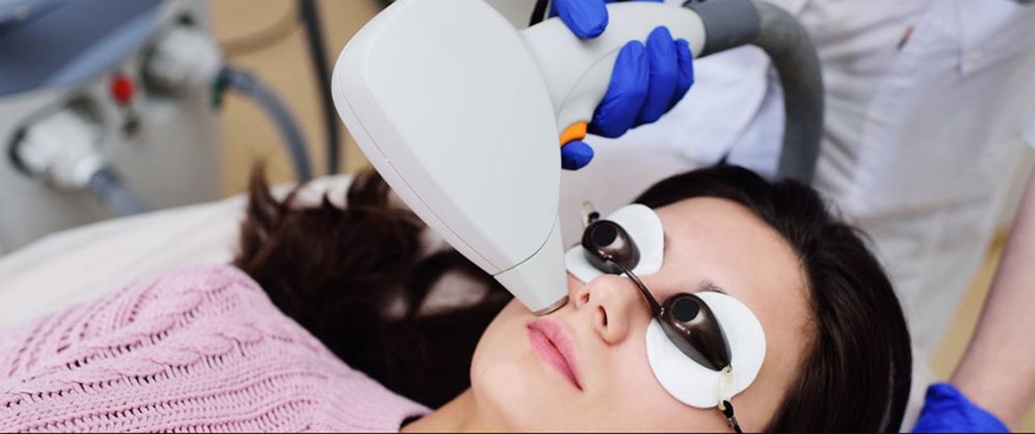 Laser Facial Hair Removal for Ladies