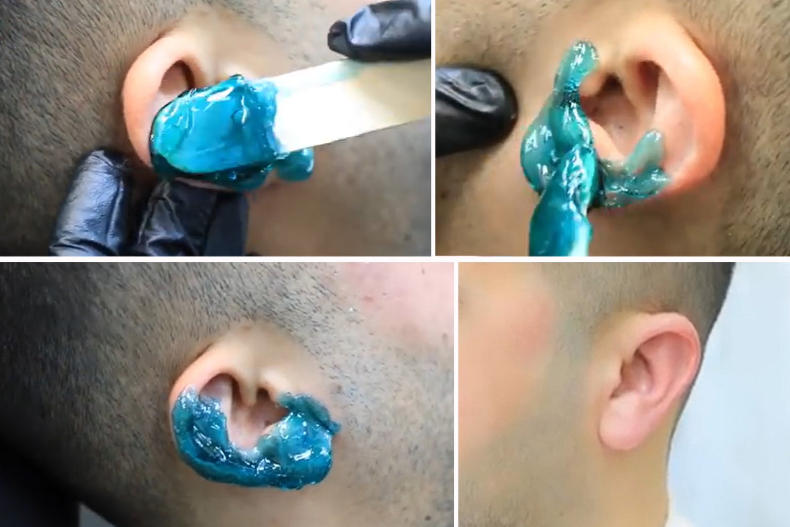 ear waxing for man proсess