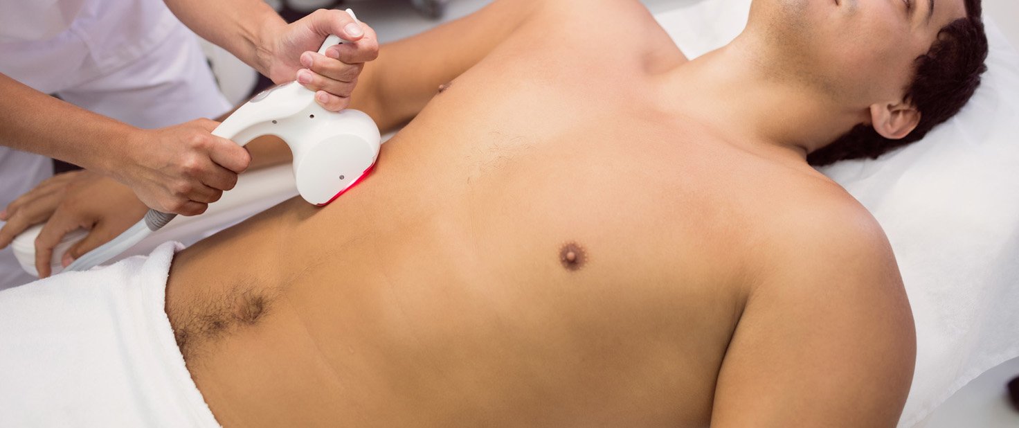 full body laser hair removal for men